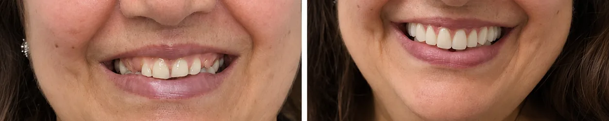 Caso real 3 antes e depois
