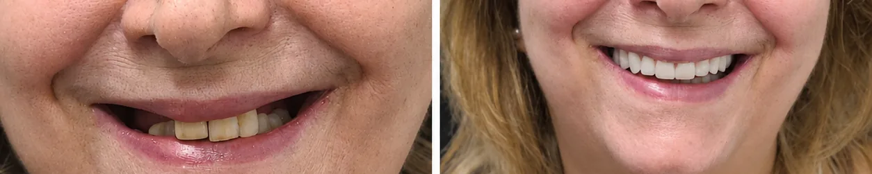 Caso real 5 antes e depois